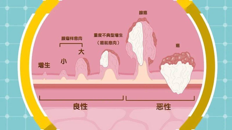 甲基化检测:走出误区,认识真实价值